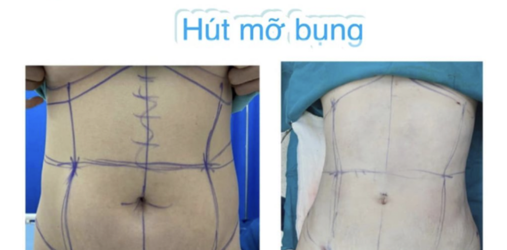                 Hình ảnh chứa nỗi đau trong bài viết quảng cáo